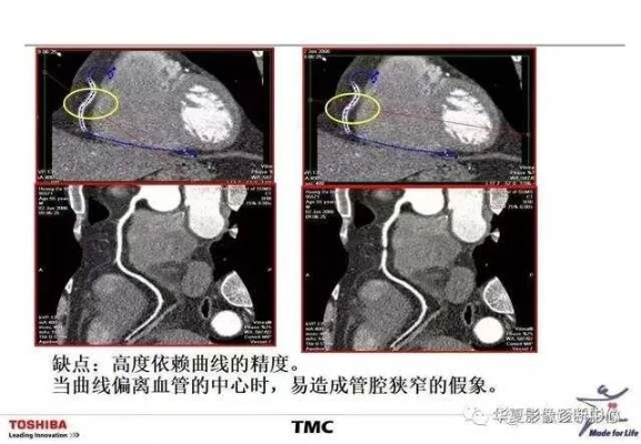 层叠消融官方下载,理论解答解释定义&amp;高级款_v7.204