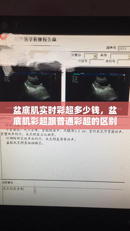 盆底肌实时彩超多少钱，盆底肌彩超跟普通彩超的区别 
