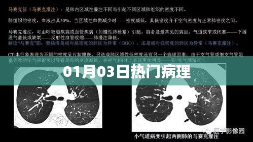 最新热门病理资讯，01月03日解读