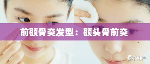 前额骨突发型：额头骨前突 