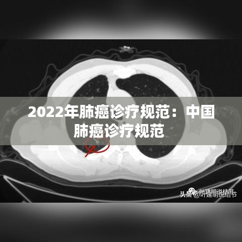 2022年肺癌诊疗规范：中国肺癌诊疗规范 