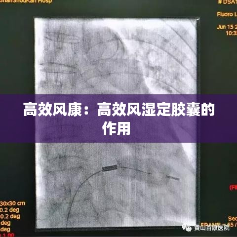 高效风康：高效风湿定胶囊的作用 