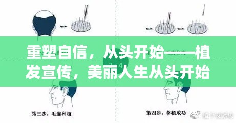 飞奇钩货